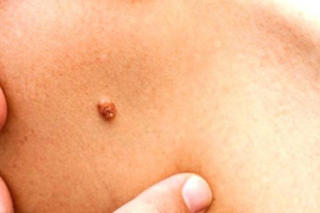 genital-sigil genital-sigil