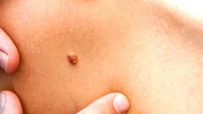 genital-sigil genital-sigil