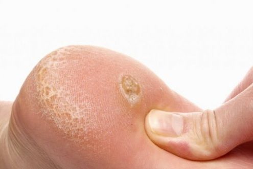 sigil-nasil-olur sigil-nasil-olur